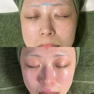 メンズ 肌質改善＆脱毛 【M Mondo】のエステ・リラクイメージ