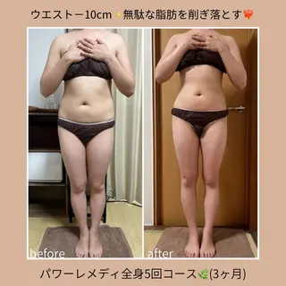《本気痩せ×疲労改善 》  BILOOPのエステ・リラクイメージ