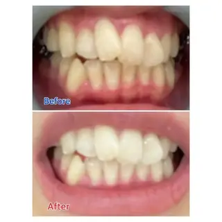 M渋谷 ホワイトニングのエステ・リラクイメージ