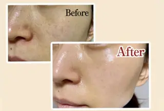 脱毛&シェービング 専門店　平岡のエステ・リラクイメージ