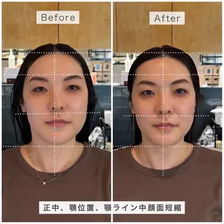 小顔矯正スパ/艶髪 湖香(コノカ)のエステ・リラクイメージ