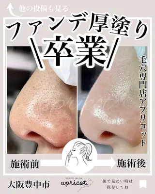 ヘッドスパ専門/豊中 apricotのエステ・リラクイメージ