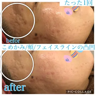 ミディアム カラー パーマ ヘアアレンジ キッズ ネイル マツエク・マツパ EnsorClair 代表 野口真央のエステ・リラクイメージ