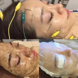 💙美容鍼💙美顔矯 正🧡Brilo🧡のエステ・リラクイメージ