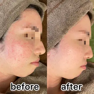 ポテンツァ&針美容 バストアップ専門店のエステ・リラクイメージ