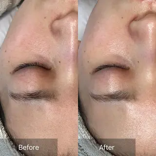 ebcs 8のエステ・リラクイメージ