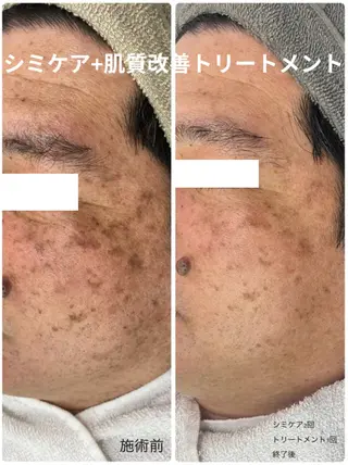 メンズ えだ すがこのエステ・リラクイメージ