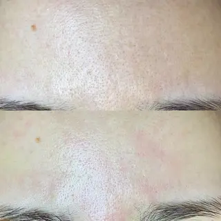 毛穴・頭皮 専門店💪のその他イメージ