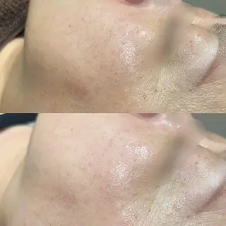 EARTH 小林 郁海のエステ・リラクイメージ