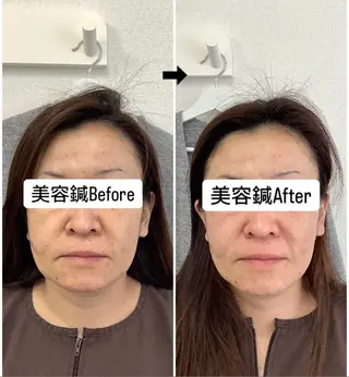 美容鍼灸×小顔整体♡ ハリサロンドオフ堺東のその他イメージ