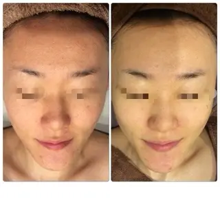 小林 春美のエステ・リラクイメージ