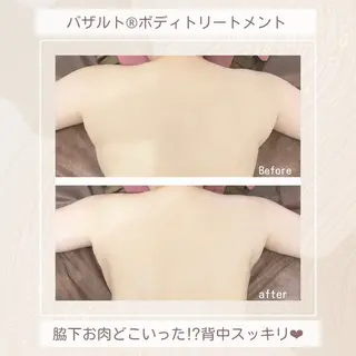 35歳からの エイジングケアサロンのエステ・リラクイメージ