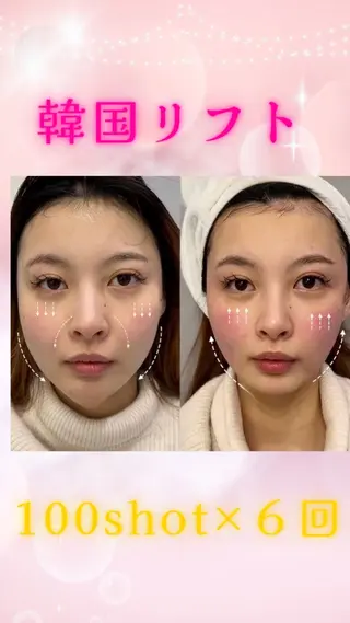 ショート 愛維美水光美肌専門店 メンズレディースokのエステ・リラクイメージ