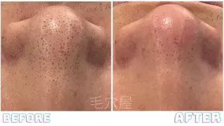 毛穴/毛穴洗浄専門 エミルカ船橋のエステ・リラクイメージ