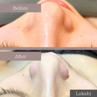 全身脱毛／リラク Lokahiのエステ・リラクイメージ