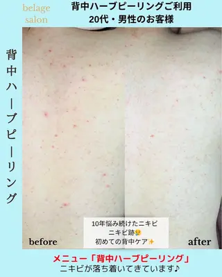 ベラージュ【美背中・ 美尻・フェイシャル】のエステ・リラクイメージ