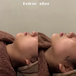 # fu♡のエステ・リラクイメージ