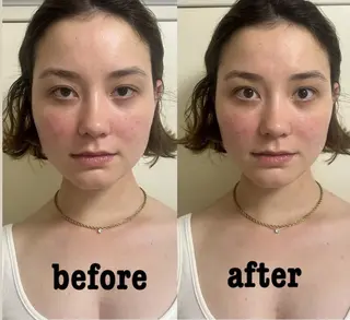 佐藤 咲希のエステ・リラクイメージ