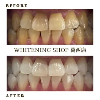 メンズ ホワイトニング ショップ葛西店のその他イメージ