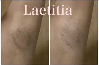 レティティア【Laetitia】所属・レティティア秋葉原店 Yoshizawaのエステ・リラクイメージ