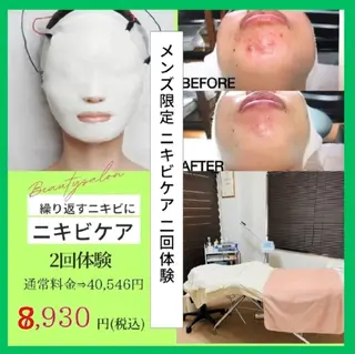 ニキビケア◇ニキビ跡 レゾン京橋店　峠山のエステ・リラクイメージ