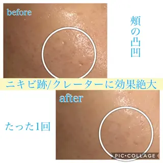 ミディアム カラー パーマ ヘアアレンジ キッズ ネイル マツエク・マツパ EnsorClair 代表 野口真央のエステ・リラクイメージ