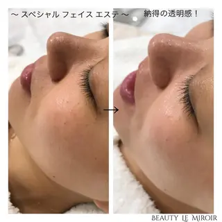 ビューティー ミロワールのエステ・リラクイメージ