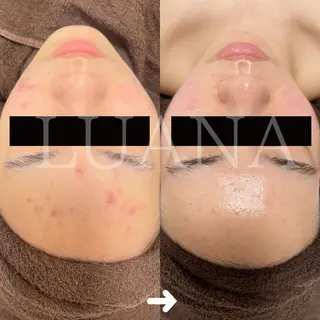 LUANA TAKAGIの眉毛・アイブロウイメージ