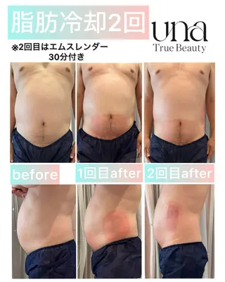脂肪冷却サロンUNA SHIROKANEのその他イメージ