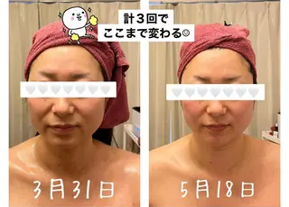 35歳からの エイジングケアサロンのエステ・リラクイメージ