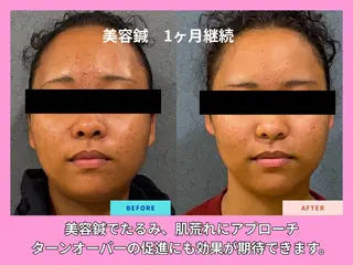 美容鍼・リラクゼーションサロン 晴々所属・清水 茜音のその他イメージ