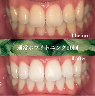 futaba ホワイトニング/天神のエステ・リラクイメージ