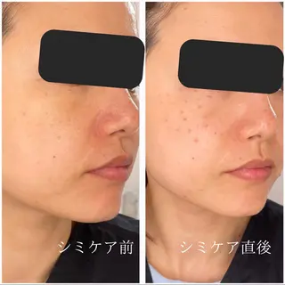 肌質改善エステ chiffonのエステ・リラクイメージ