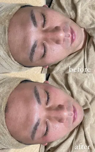 エステサロン Mi-mi.iのエステ・リラクイメージ