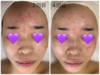 COCO beautyサロンのエステ・リラクイメージ