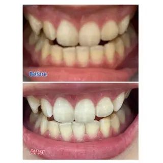 Ｍ渋谷 ホワイトニングのエステ・リラクイメージ