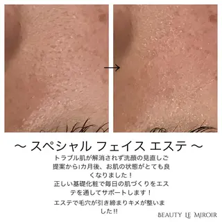ビューティー ミロワールのエステ・リラクイメージ