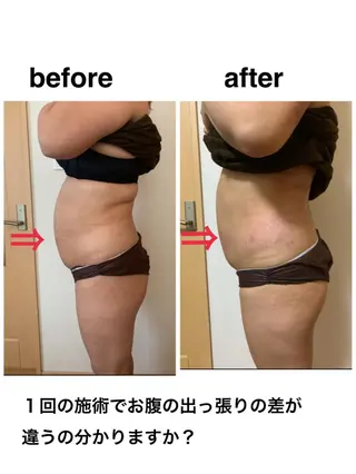 痩身/脱毛/ネイル HARUKAのエステ・リラクイメージ