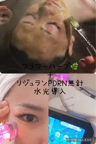 y.laBelle 艶肌・小顔・肌質改善のエステ・リラクイメージ