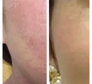 LaLaようこ所属・首藤 洋子のエステ・リラクイメージ