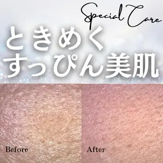 毛穴専門店Bebe 蘭のエステ・リラクイメージ