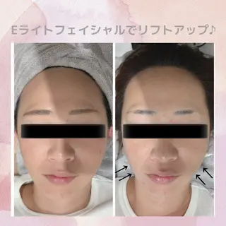 小顔美肌痩身サロン Ranのその他イメージ