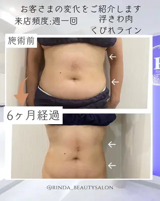 ブライダル痩身×脱毛 尼崎駅前サロンのエステ・リラクイメージ