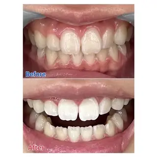 M渋谷 ホワイトニングのエステ・リラクイメージ