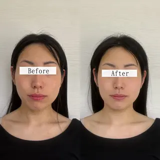 Stellum 小顔矯正&ヘッドスパのエステ・リラクイメージ