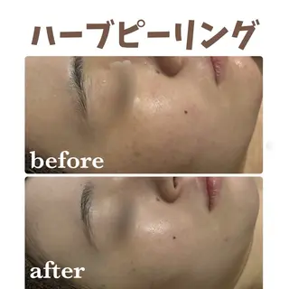 リンパケアサロン 🧡Relairのエステ・リラクイメージ