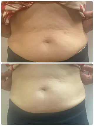 宮本 しおりのエステ・リラクイメージ