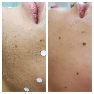 メンズ 阿部 恵子のエステ・リラクイメージ