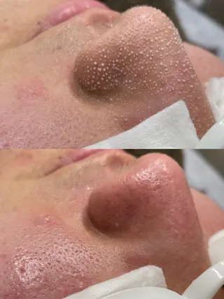 Tug 高知駅前店/ NANAMI🌐のエステ・リラクイメージ