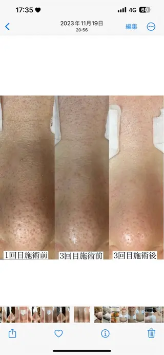 毛穴専門店 マカナアロハのエステ・リラクイメージ